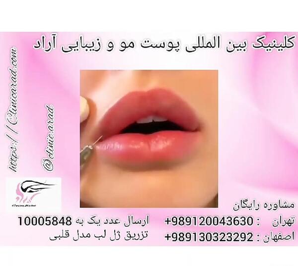 عکس مدل لب قلبی