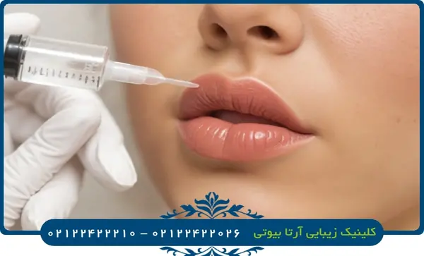 عکس مدل لب قلبی