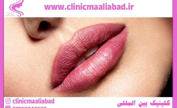 عکس ژل لب قلوه ای