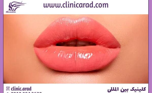 عکس ژل لب قلوه ای