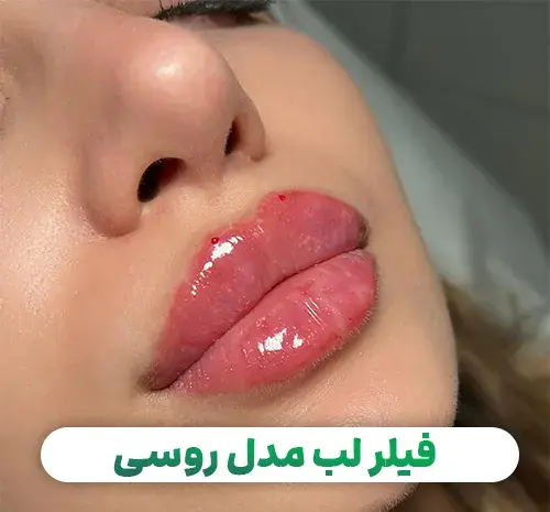 عکس دختر لب قلوه ای