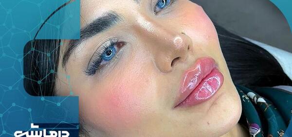 عکس ژل لب مدل قلوه ای