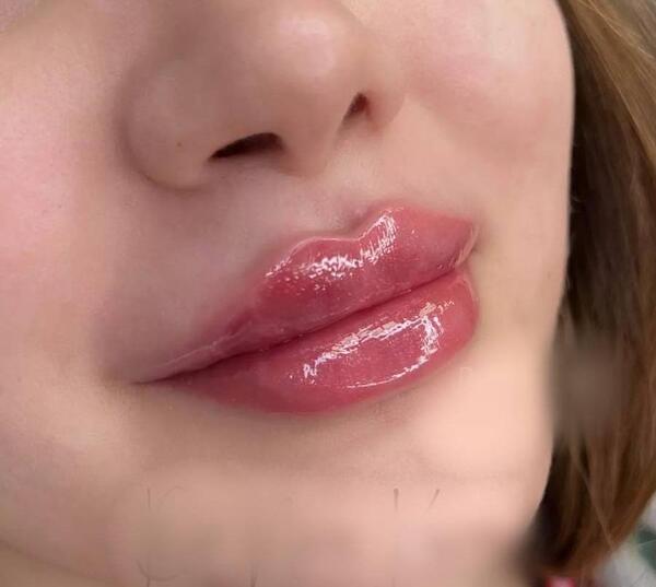 عکس ژل لب مدل قلوه ای