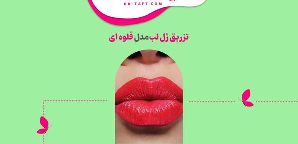 عکس ژل لب مدل قلوه ای