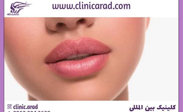 عکس ژل لب مدل قلوه ای