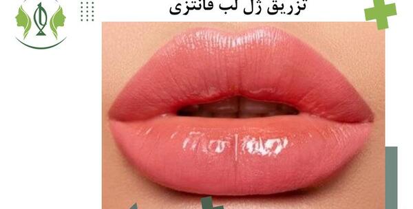 عکس ژل لب مدل قلوه ای