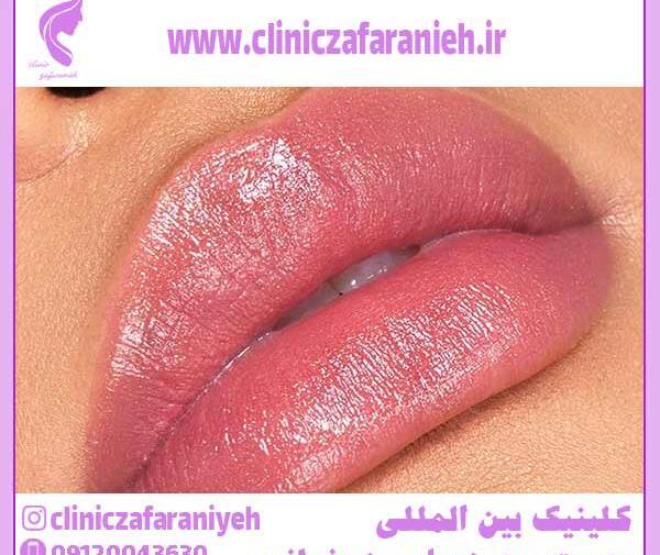 عکس ژل لب فرانسوی