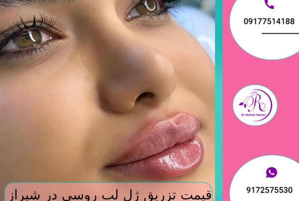 عکس ژل لب فرانسوی