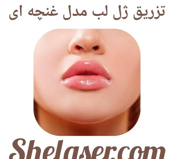 عکس لب غنچه ای
