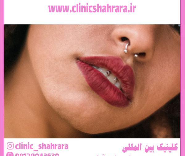 عکس لب غنچه ای