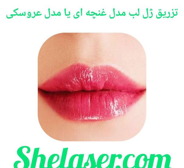 عکس لب غنچه ای