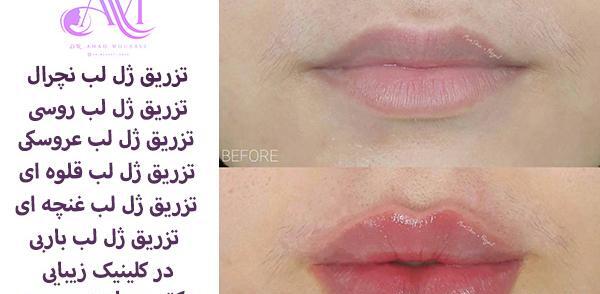 عکس مدل لب غنچه ای