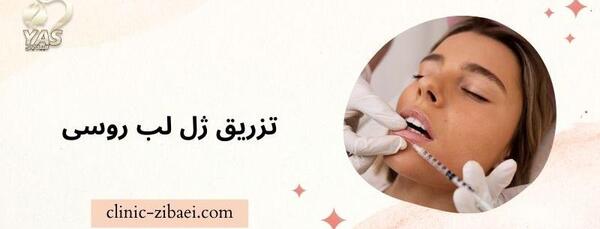 عکس مدل لب غنچه ای