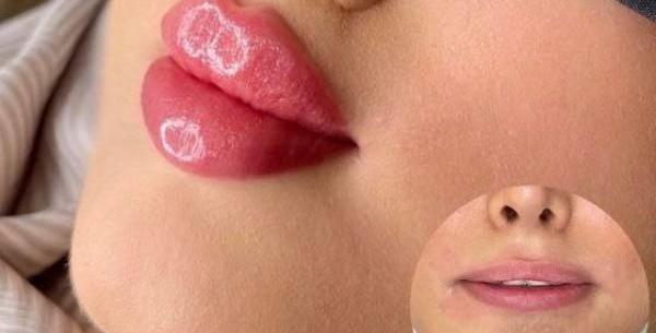 عکس مدل لب غنچه ای