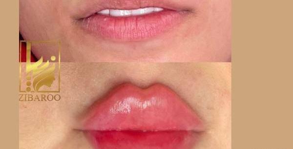 عکس مدل لب غنچه ای