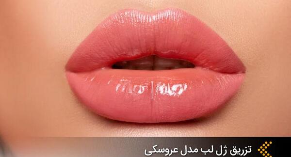 عکس لب ژل زده عروسکی