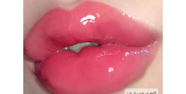 عکس لب ژل زده عروسکی
