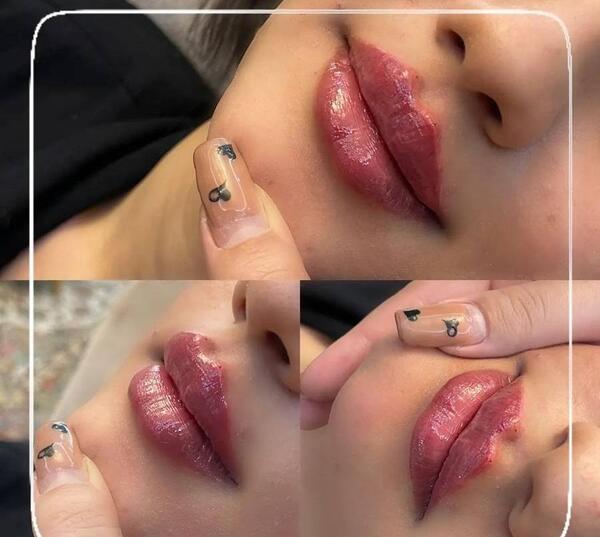 عکس لب ژل زده عروسکی