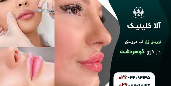 عکس مدل لب عروسکی