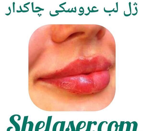 عکس مدل لب عروسکی