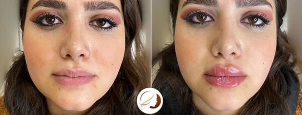 عکس مدل لب عروسکی