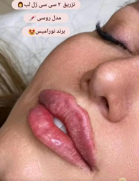 عکس مدل لب عروسکی