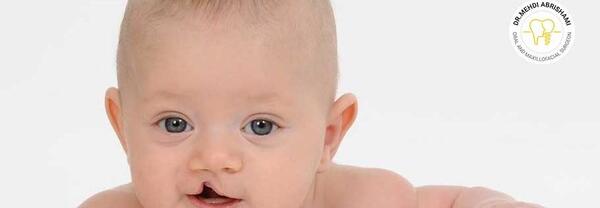 عکس بچهای لب شکری