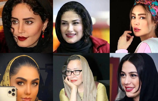عکس پروتز لب سحر قریشی