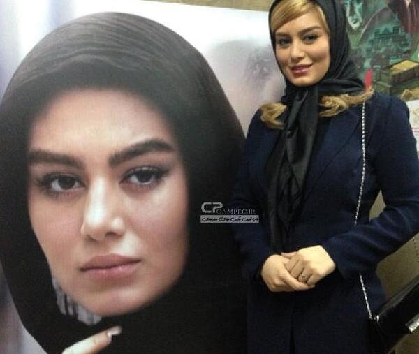عکس پروتز لب سحر قریشی
