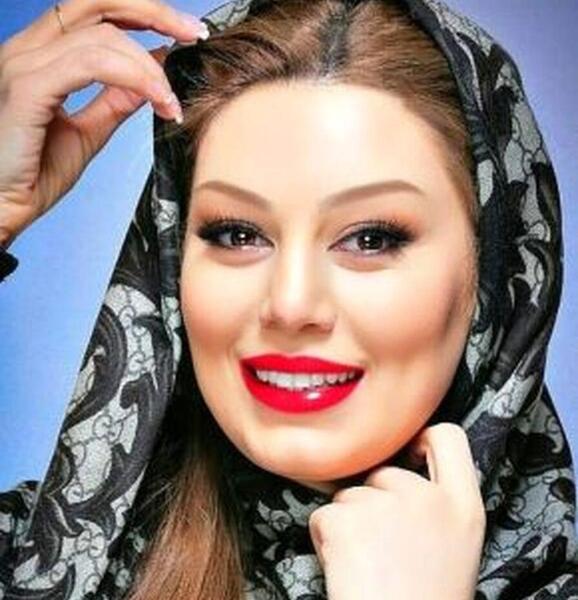 عکس پروتز لب سحر قریشی