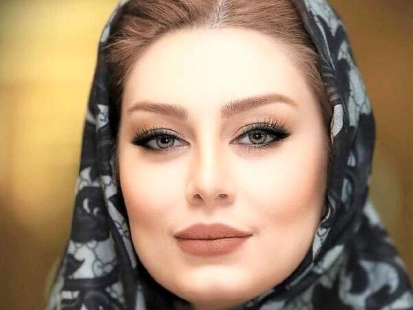 عکس پروتز لب سحر قریشی