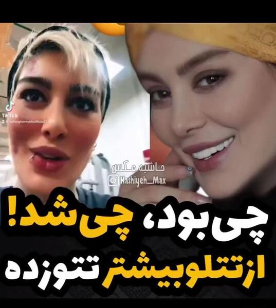 عکس پروتز لب سحر قریشی