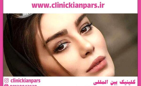 عکس پروتز لب سحر قریشی