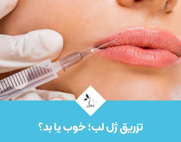 عکس تزریق ژل لب دو سی سی