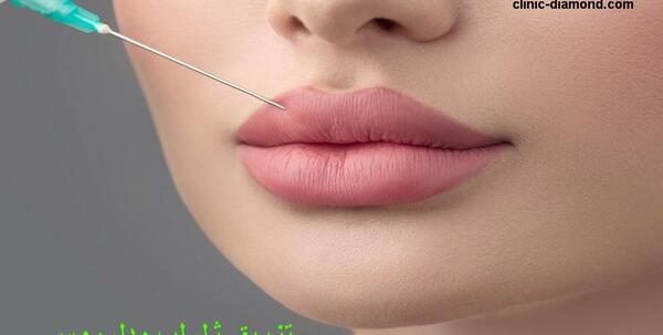 عکس تزریق ژل لب دو سی سی