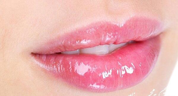 عکس عفونت لب بعد از تزریق ژل