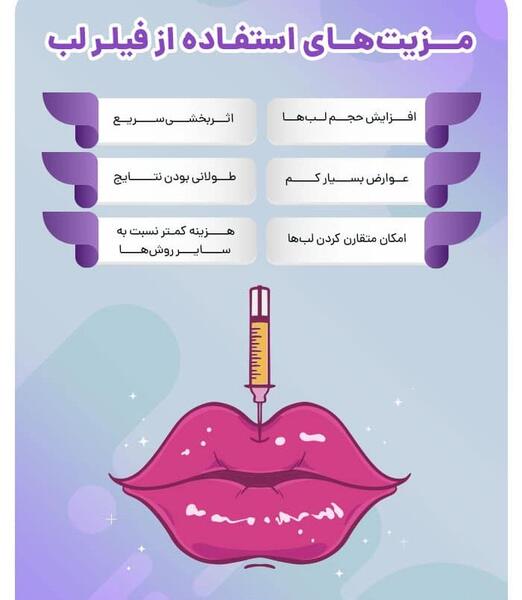 عکس ژلیش لب