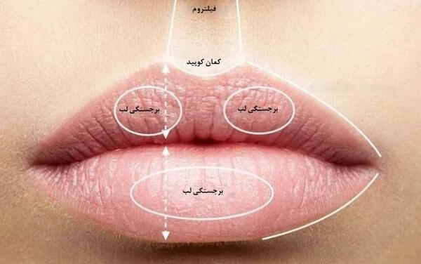 عکس لب ژل روسی