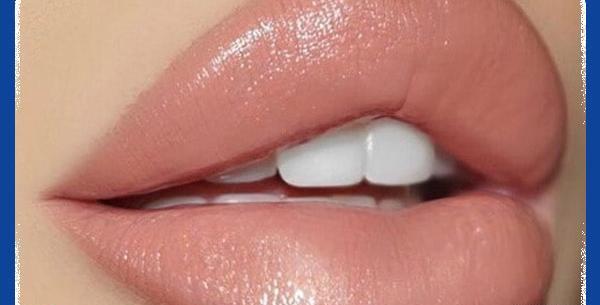 عکس لب ژل روسی