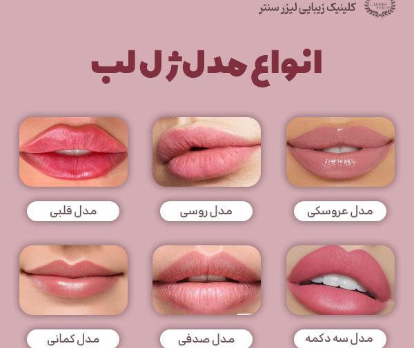 عکس لب ژل روسی