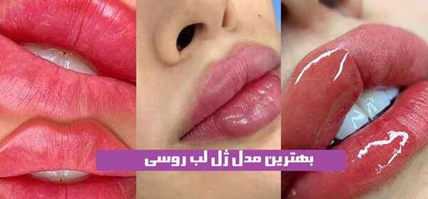 عکس لب ژل روسی
