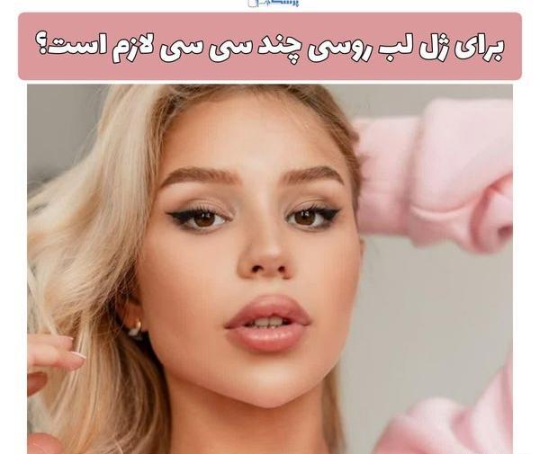 عکس لب ژل روسی