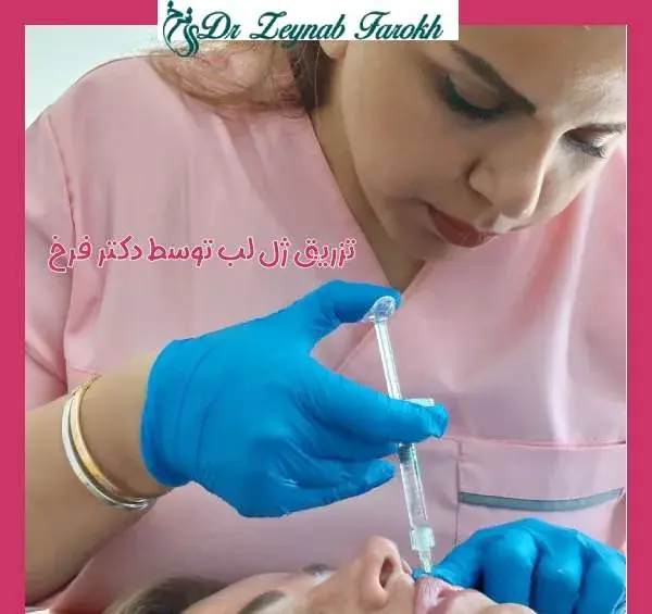 عکس لب ژل زده شده