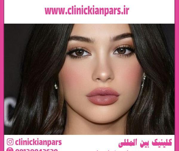 عکس لب ژل زده شده