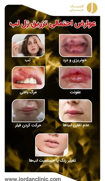 عکس لب ژل زده شده