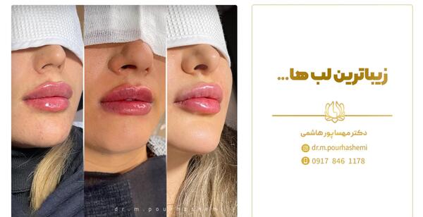 عکس زیباترین لب دنیا