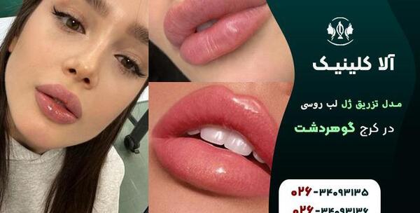 عکس زیبای لب