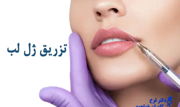 عکس زیبای لب