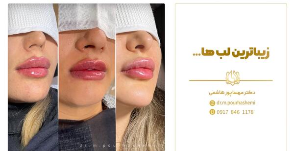 عکس زیبای لب