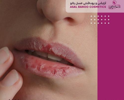 عکس رژ لب روی گردن